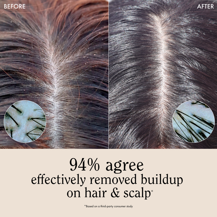 Deep Cleansing Bundle